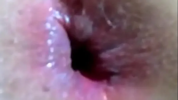 Vis Its To Big Extreme Anal Sex With 8inchs Of Hard Dick Stretchs Ass nye film