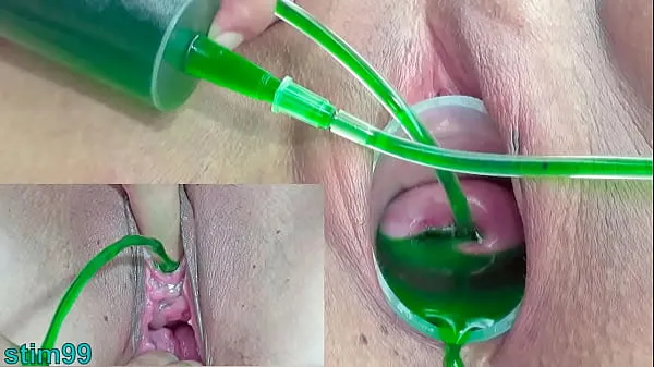 Cervix and Pee Hole Inflation with Injections for Japanese Lesbians نئی فلمیں دکھائیں